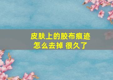 皮肤上的胶布痕迹怎么去掉 很久了